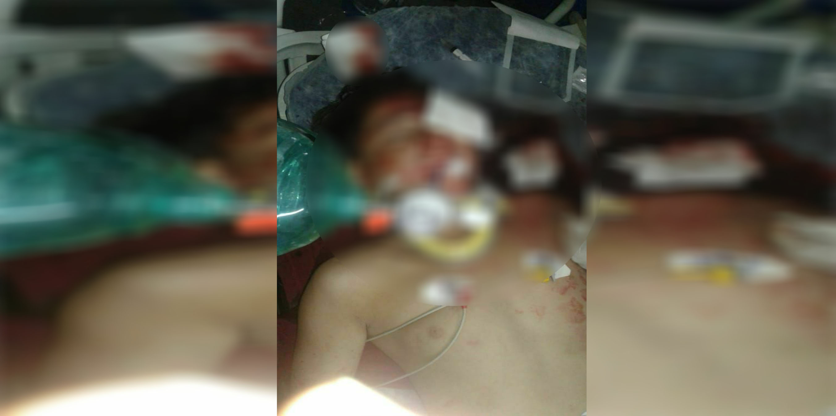 Artêşa dagîrker li Efrînê zarokek kuşt, yek jî birîndar kir