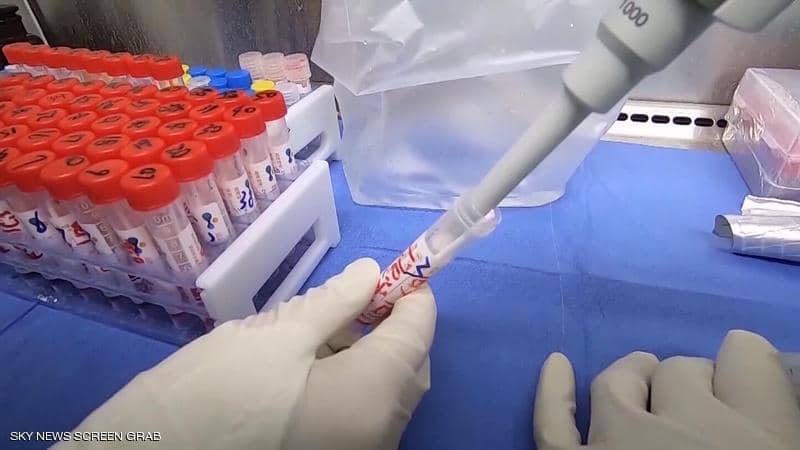 طفرة جديدة تطرأ على كورونا.. وآمال بتحوله إلى “فيروس وديع”