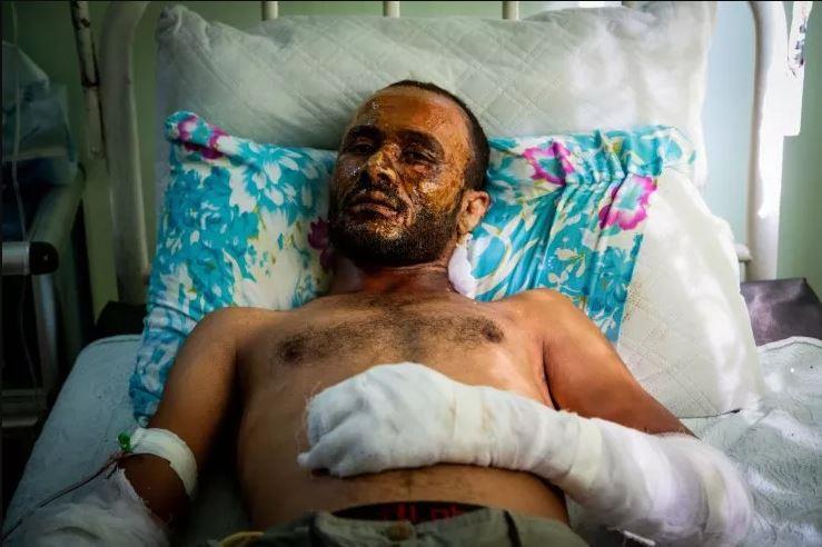 قتلُ الكرد بالسلاحُ الكيمائيّ جريمةٌ موثّقةٌ أفلتت من المساءلةِ