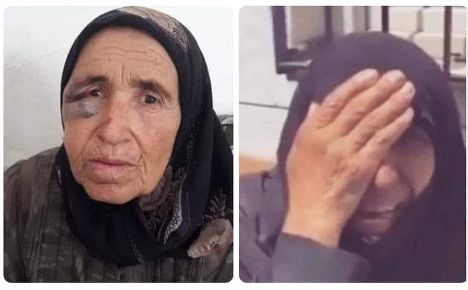 نِصفُ وَجه