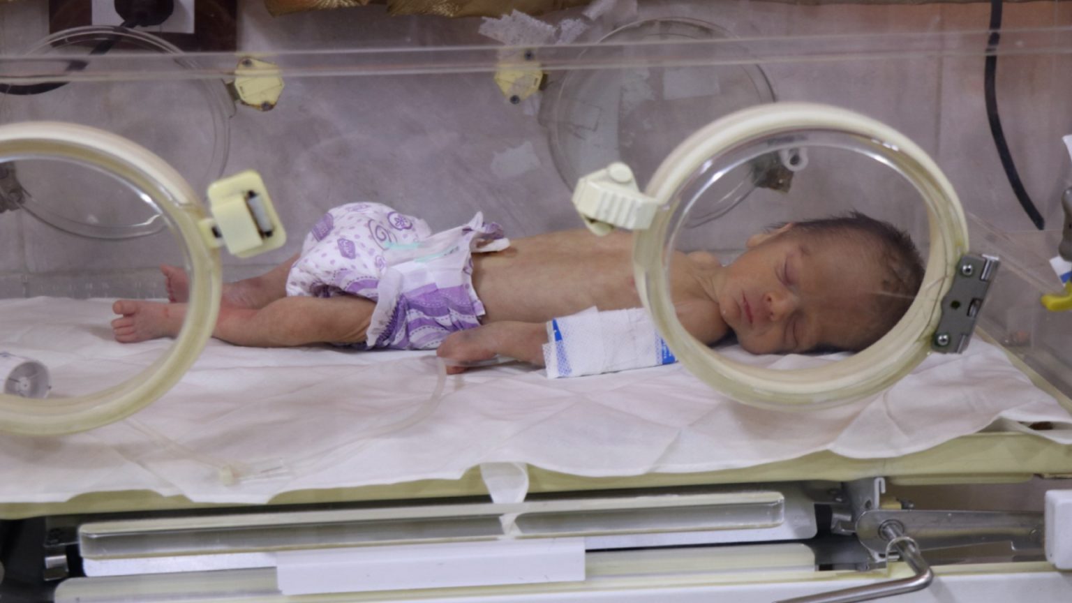 فقدان حليب الأطفال في حيّي الشيخ مقصود والأشرفية المُحاصرين