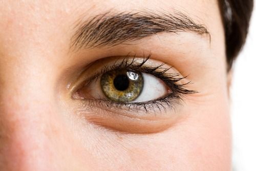 انتفاخ العين… أسبابه وعلاجه بطرق مختلفة