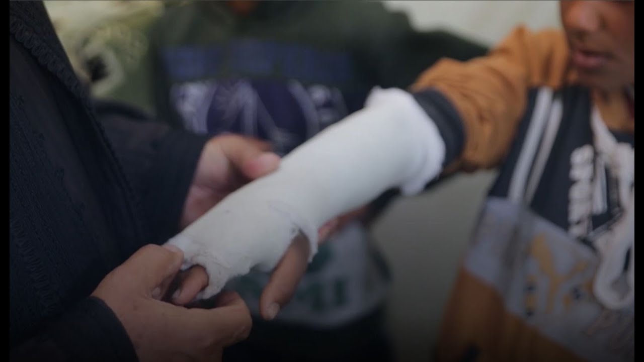 جبارة الكسور بالطب العربي رجل خبرها بلمسة يد