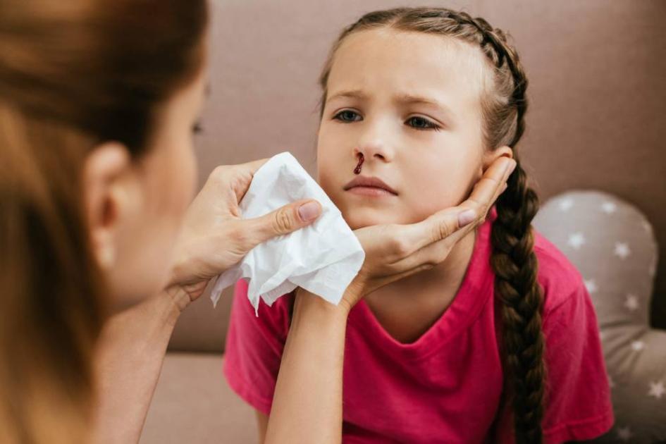 إليك سبعة أسباب لنزيف الأنف والإسعافات الأولية لمعالجته