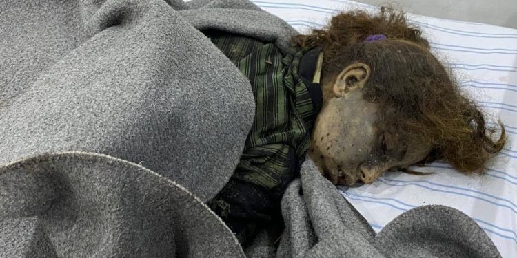 استشهاد طفلة ووالدتها بقصف المحتل التركي