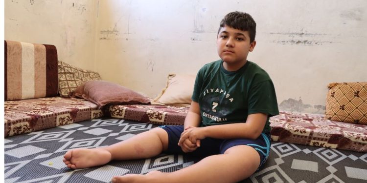طفلٌ منسيّ في زوايا مركز إيواء… يأمل المشي كأقرانه