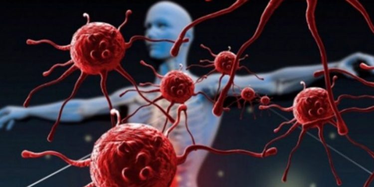 كيف يتخفى السرطان أثناء انتشاره من عضو إلى آخر؟