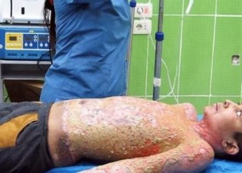 أطفال سوريا في اليوم العالمي للطفولة.. معاناة مستمرة وجهود محدودة للحماية