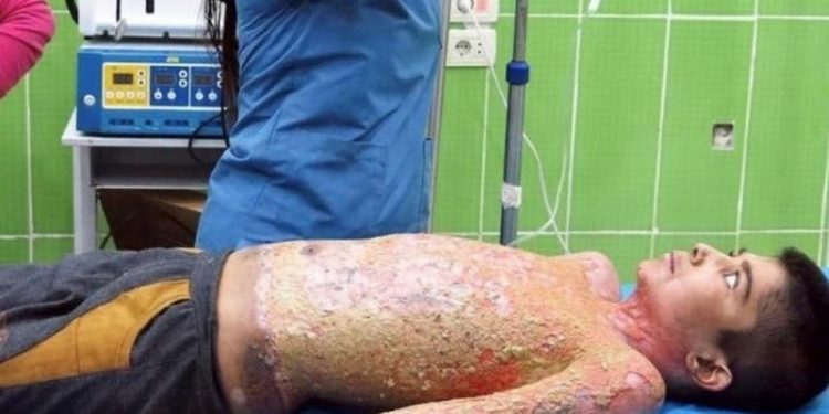 أطفال سوريا في اليوم العالمي للطفولة.. معاناة مستمرة وجهود محدودة للحماية