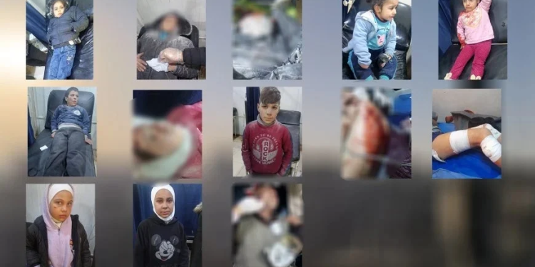 أطفال في مرمى الهجمات… حصيلة ثقيلة ومعاناة إنسانية بالحصار